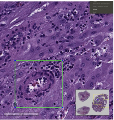 Placenta AI LLC’s mission is to revolutionize maternal health through AI-driven placenta tissue analysis.